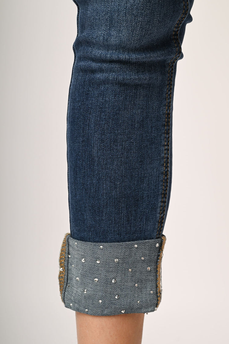 Rhinestone-turn-up skinny jeans